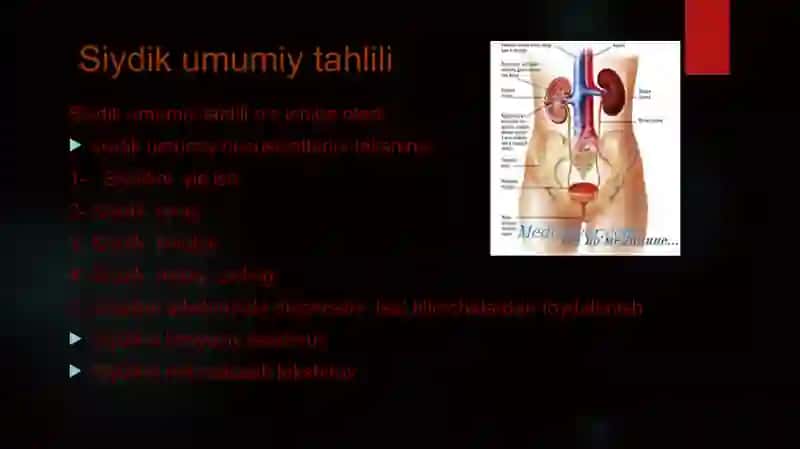 Siydik umumiy tahlili 2