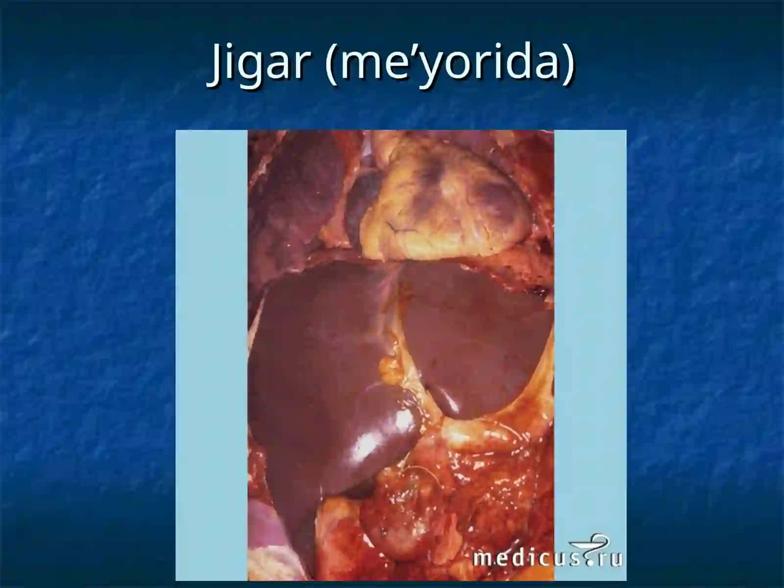 JIGARSIRROZI 2