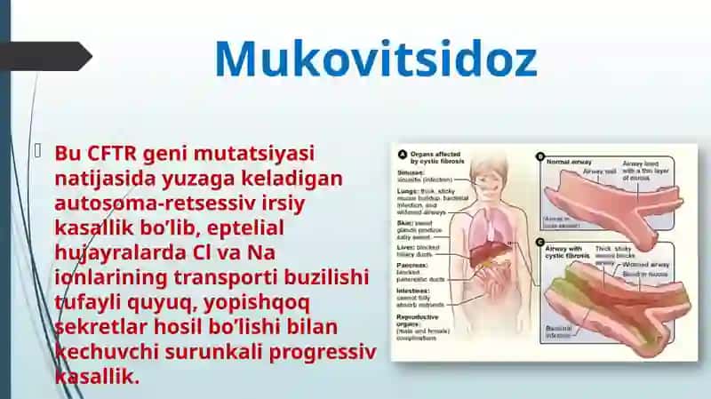 O’pkamukovitsidozi 2