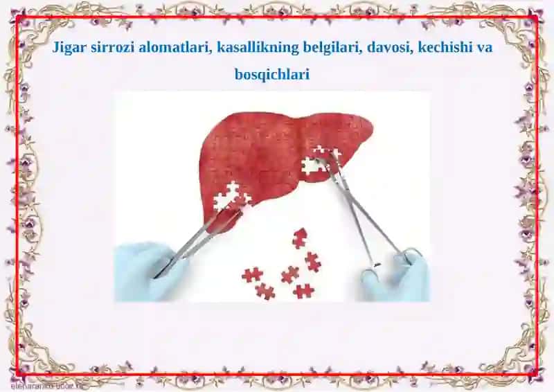 SOMATONEVROLOGIK SINDROMLAR (JIGAR KASALIKLARI) 2