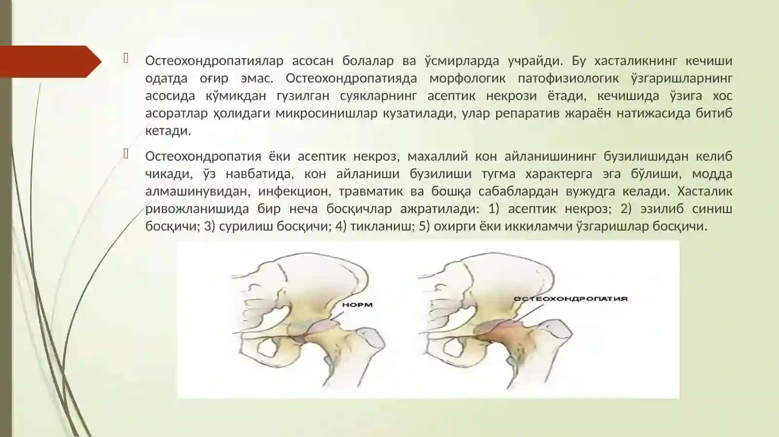 Остеохондропатиялар. Сколиоз 2