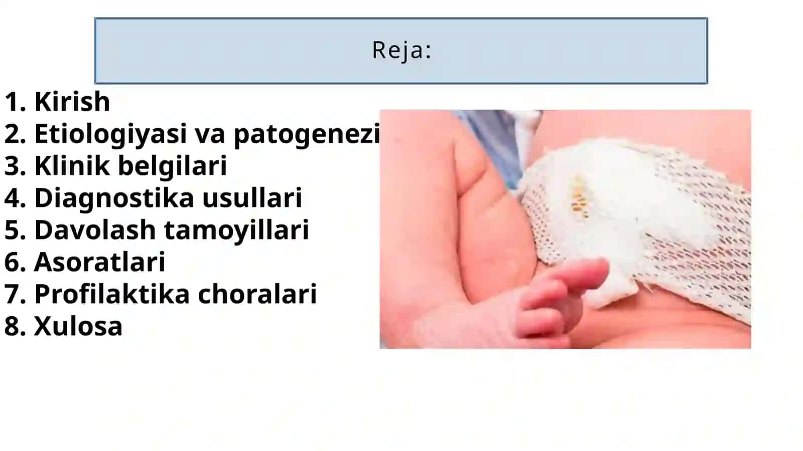 Kindikoqmalari 2