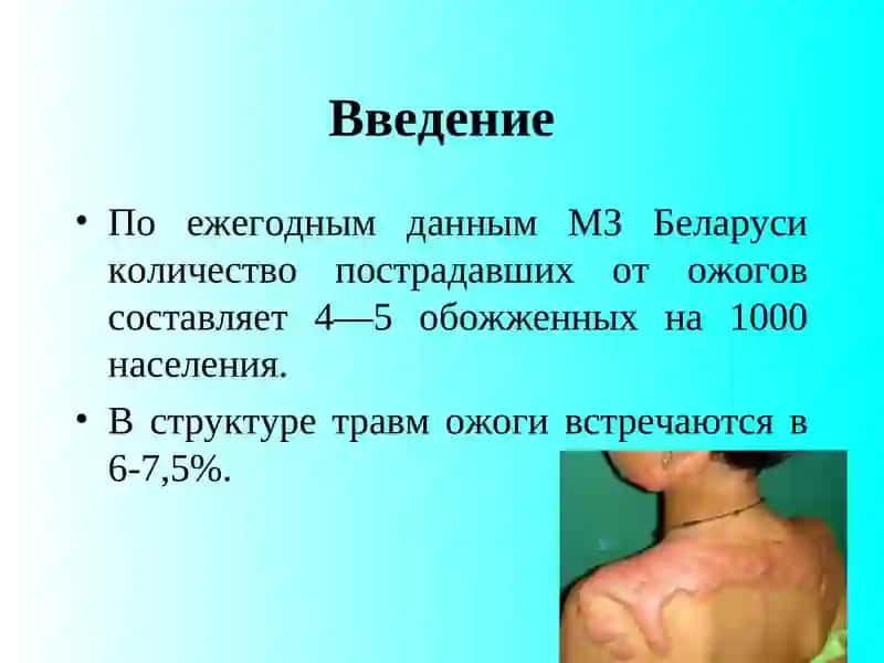 Бушадагонлар. Соғдар. Электро ёрағ'и 2