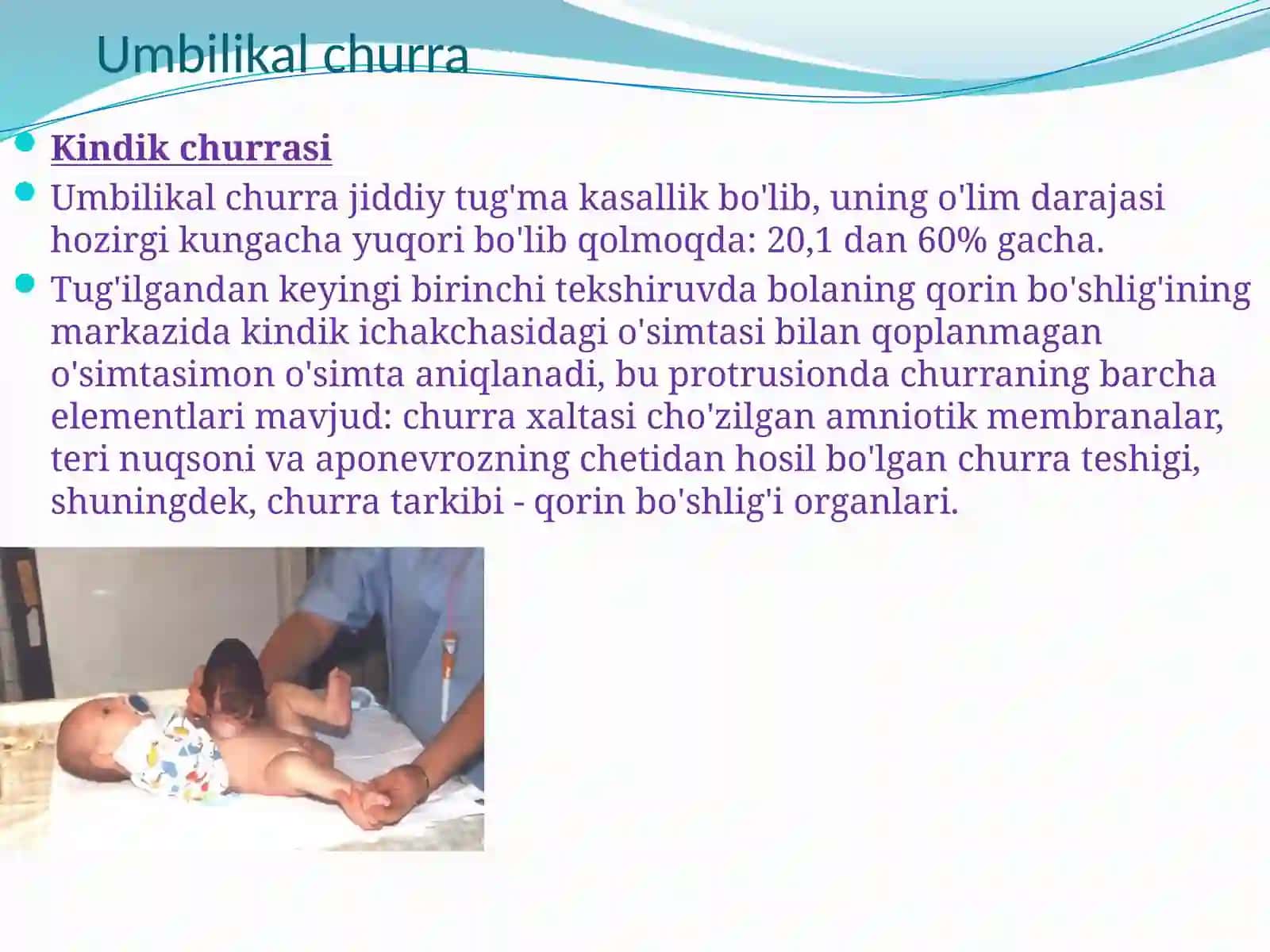 Umbilikal churra 2