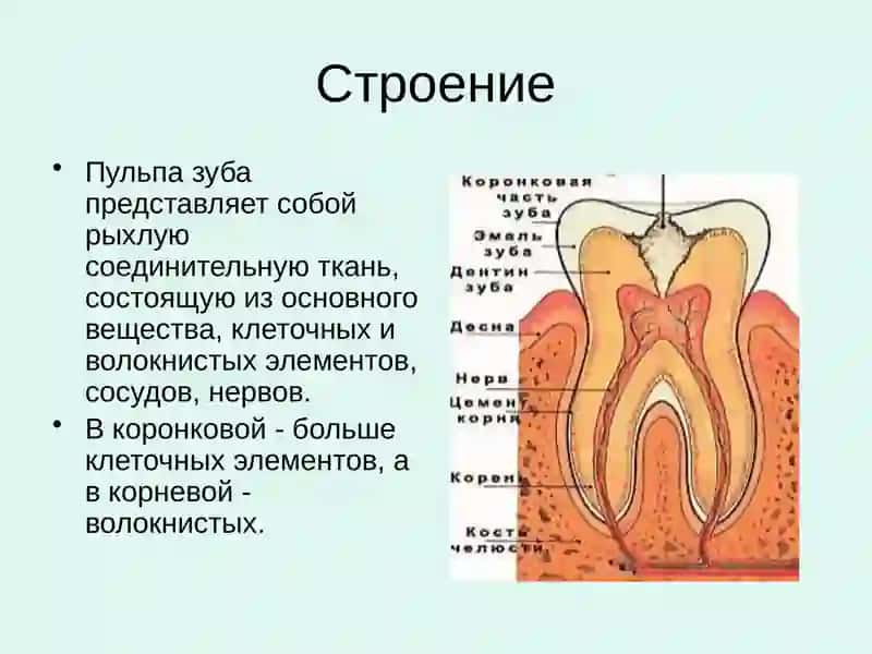 Пульпит удетей 2