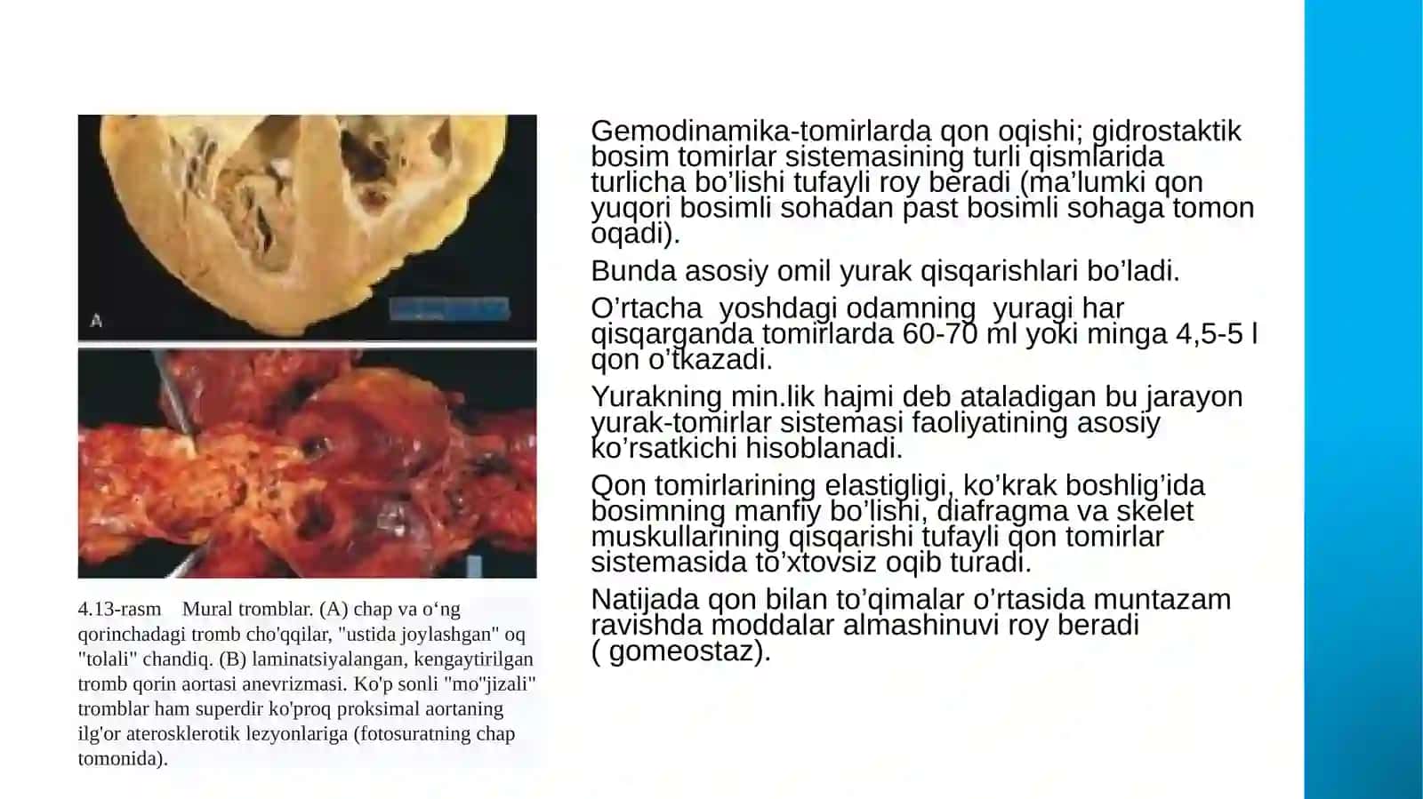 Gemodinamikbuzilishlari 2