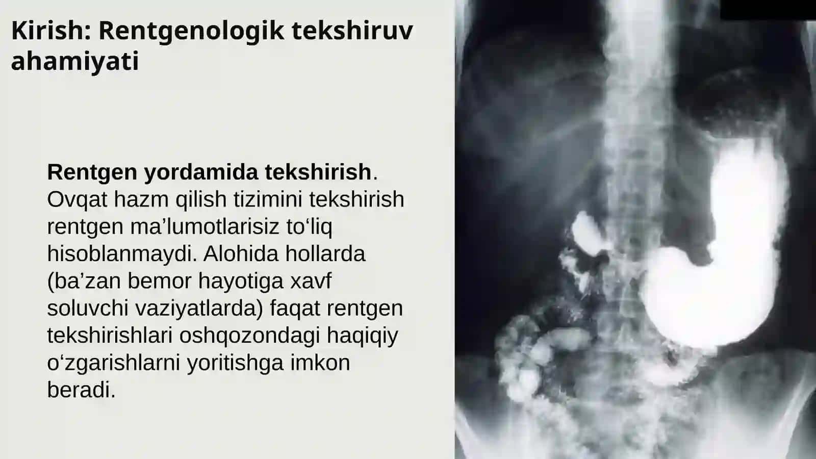 OSHQOZON RENTGENOLOGIK TEKSHIRUVI 2