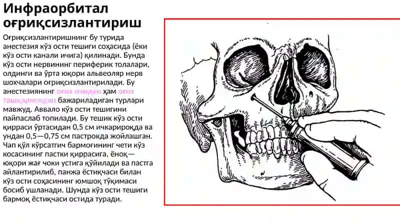 Стоматологиядаги огрик,сизлантиришлар: инфраорбитал, инцизивал, платинал 2