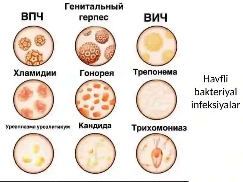 YUQUMLI KASALLIKLAR PATOLOGIK ANATOMIYASI 2