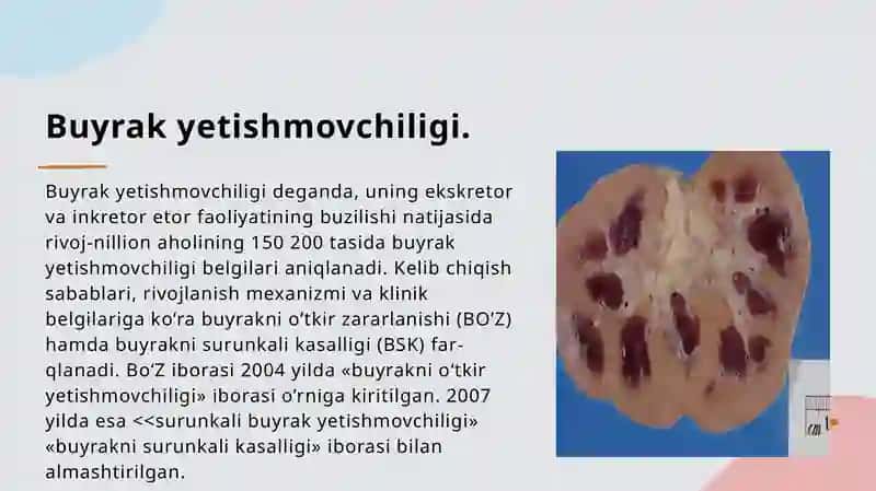 Buyrak yetishmovchiligi 2
