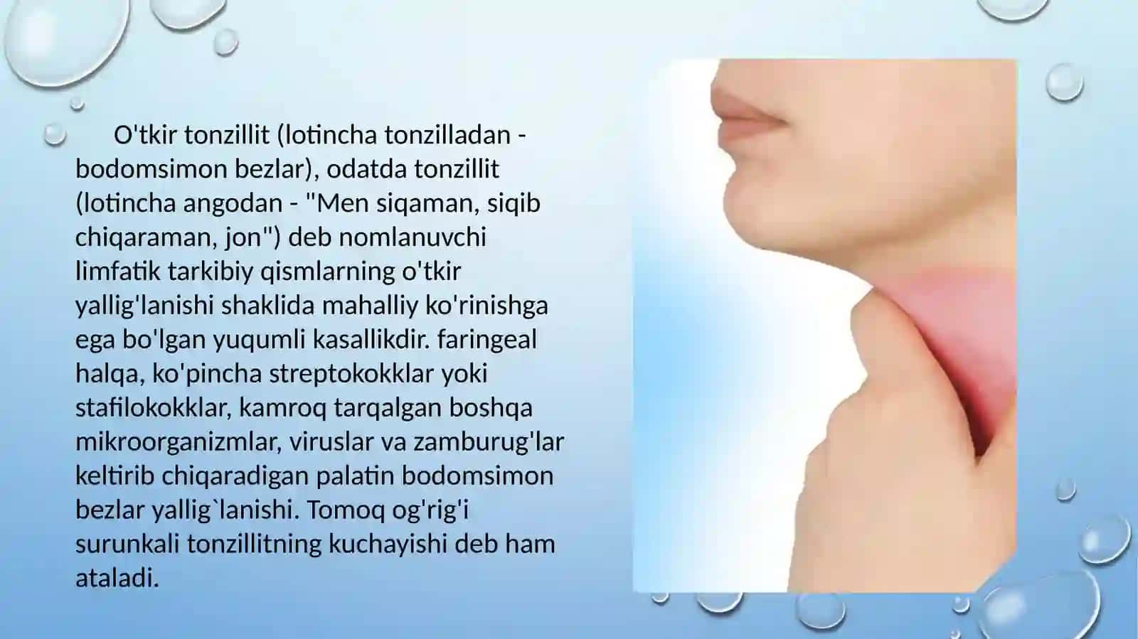 Angina va uning asoratlari 2