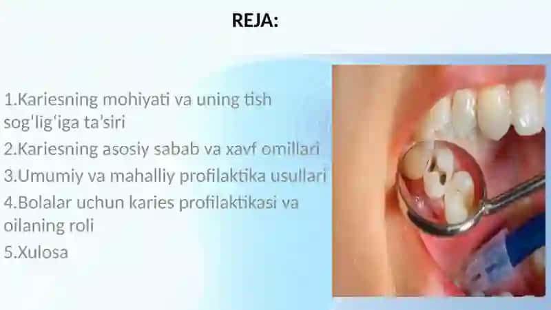 Kariesning umumiy va mahalliy profilaktikasi 2