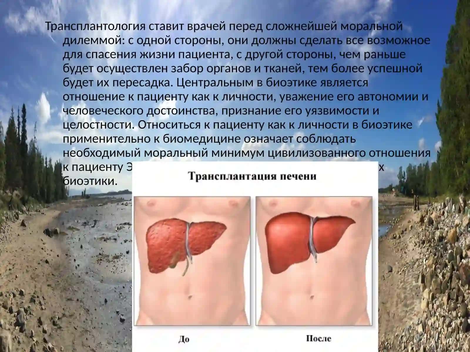 Биоэтические проблемы трансплантологии 2
