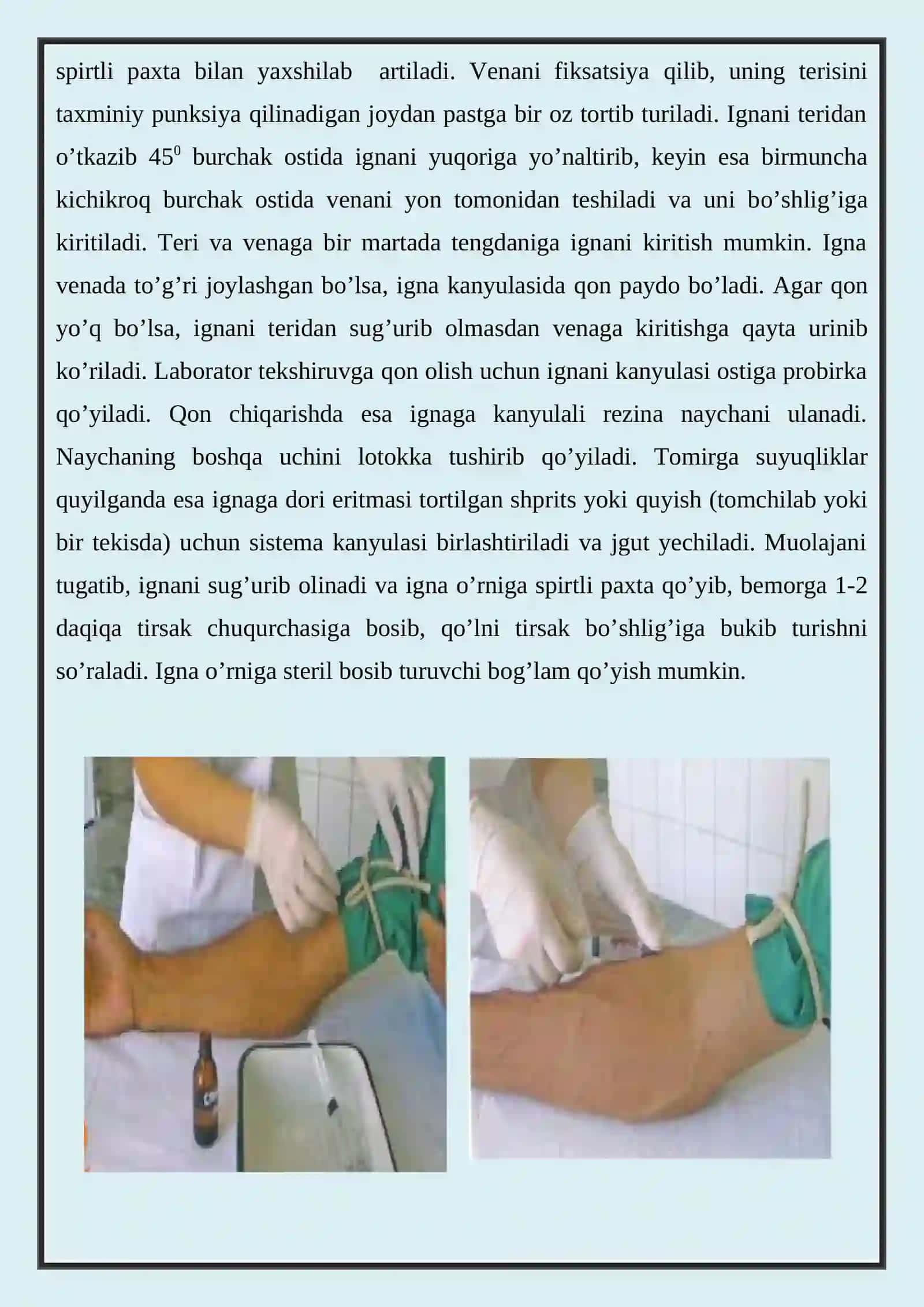 VENA QON TOMIRI PUNKSIYASI TEXNIKASI 2