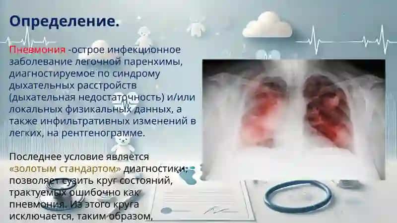 Пневмония у детей 2