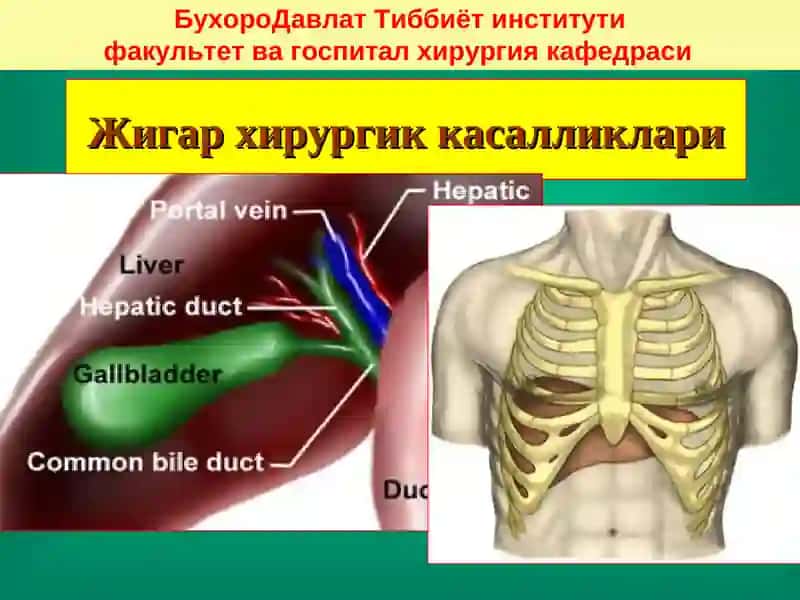 Жигар хирургик касалликлари 2