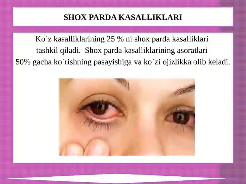 KO`ZNING OLDINGI SEGMENT KASALLIKLARI 2