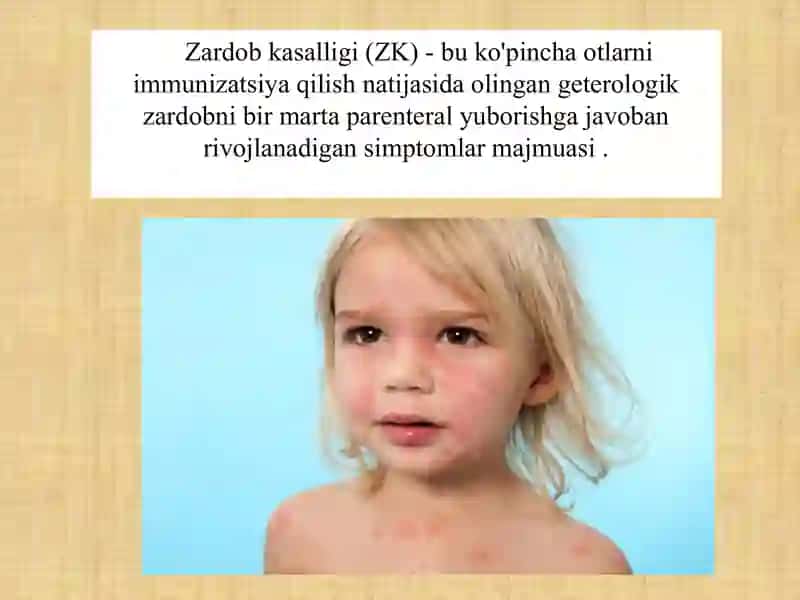 Zardob kasalligi 2