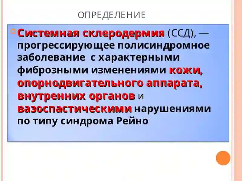 Cистемная склеродермия 2
