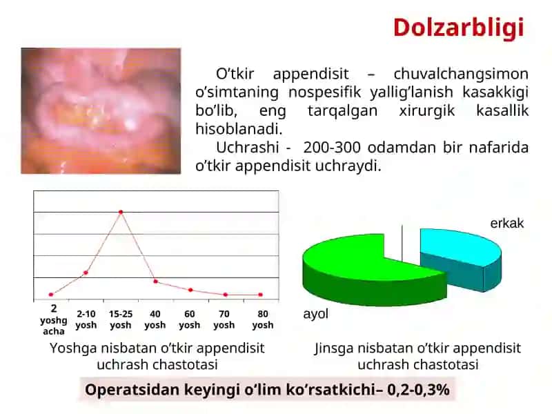 O’TKIR APPENDISIT 2
