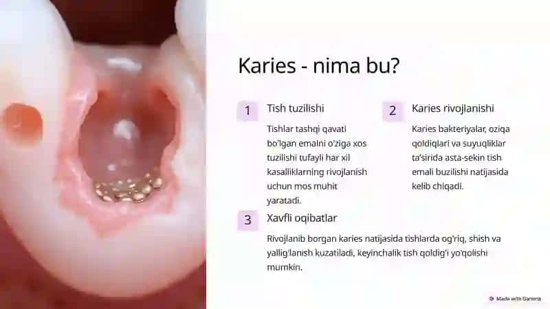 Karies kelib chiqish nazaryasi 2
