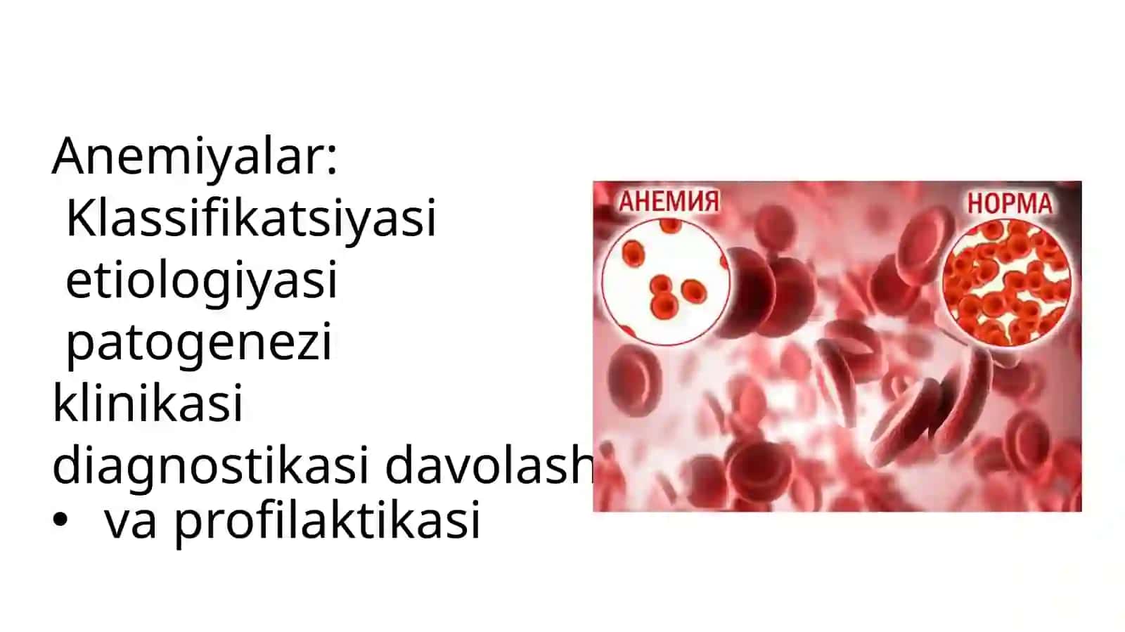 bolalarda temir tanqislik anemiyasi 2