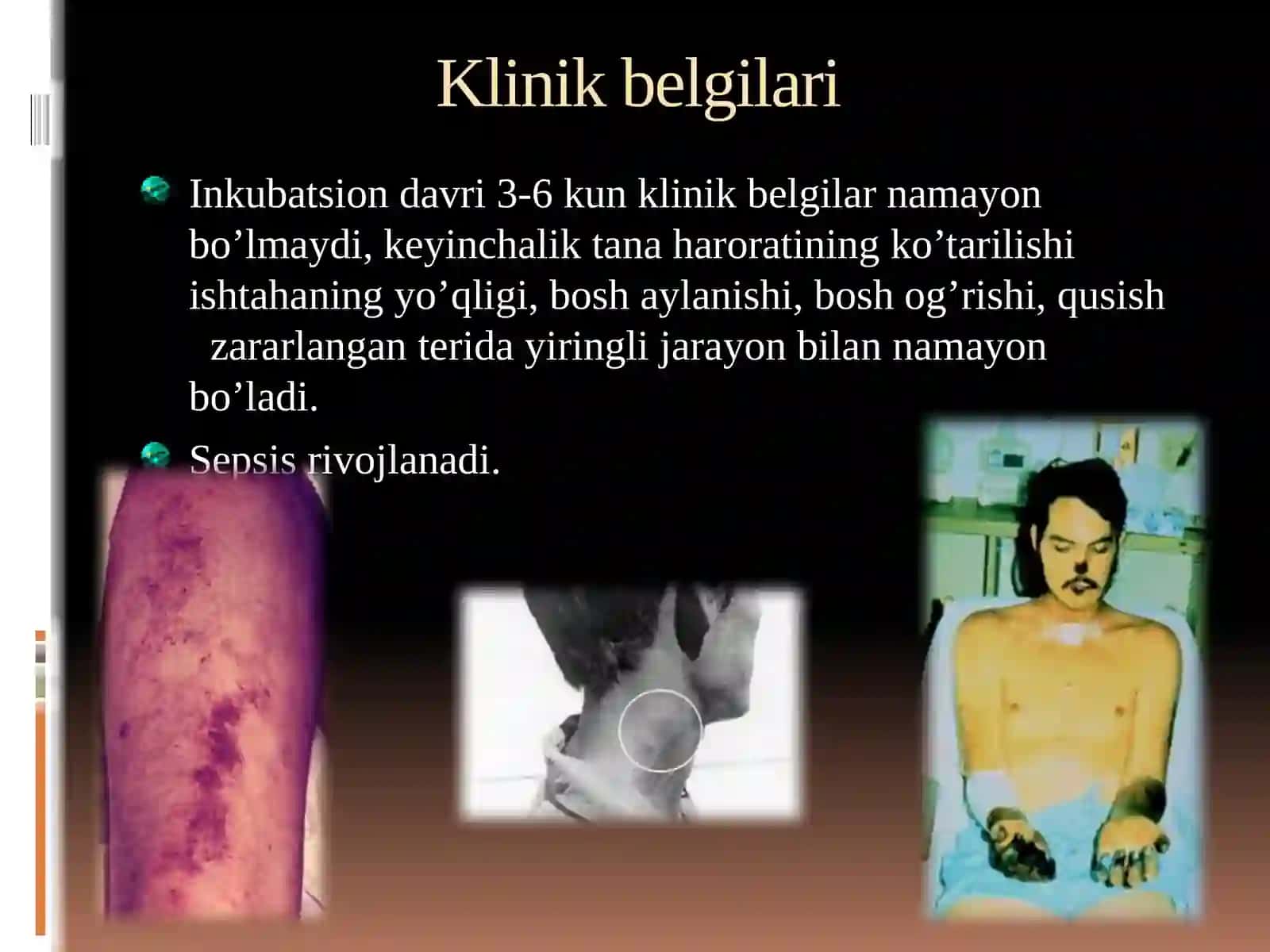 Yuqumli va yuqumsiz kasalliklar, Vitaminlar 2