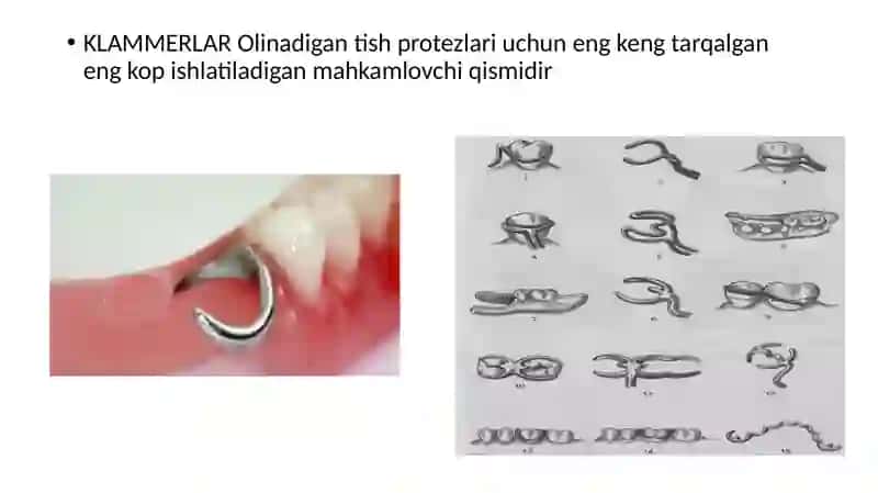 KLAMMERLAR ULARNI TURLARI VAZIFALARI 2