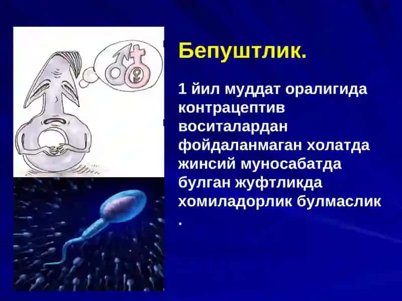 БЕПУШТЛИКАДТИ урология кафедраси 2