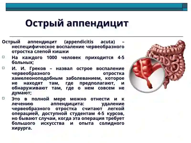 Острый аппендицит и его осложнения 2