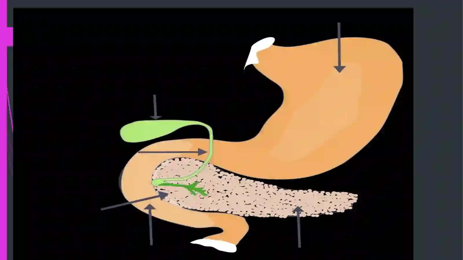 Parsendocrinicapancretis 2