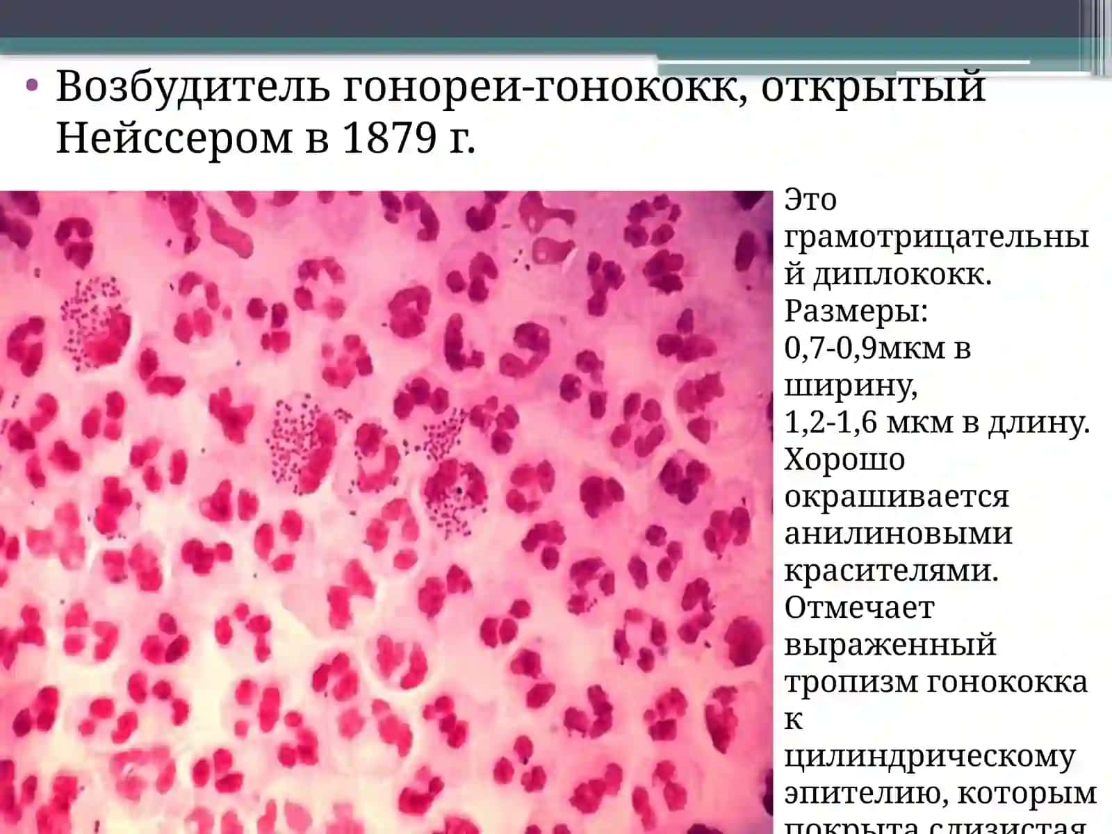 ГОНОРЕЯ 2
