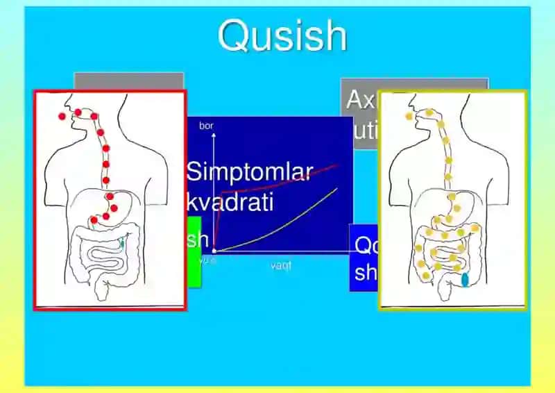 QUSISH VA QAYT QILISH SINDROMI 2