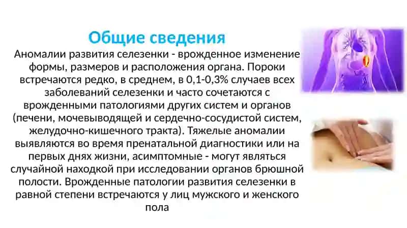 Аномалии развития селезенки – это стойкие изменения морфологической структуры органа, возникающие 2