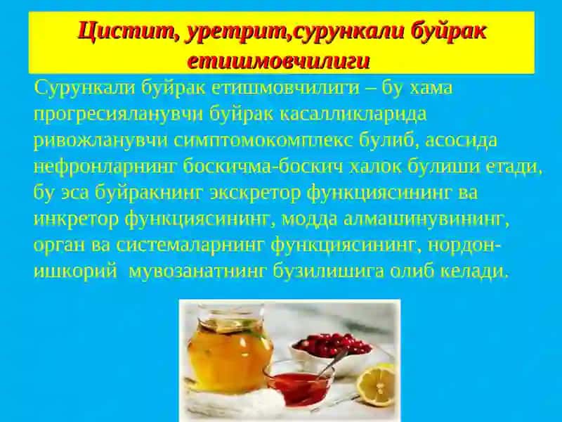 Цистит, уретрит, буйрак тош касаллиги 2