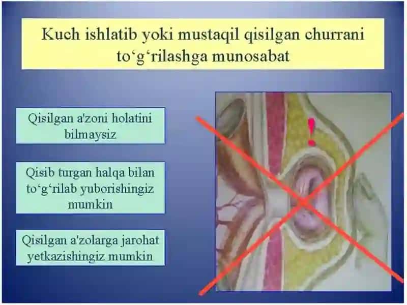 QORIN CHURRALARI VA ULARNING ASORATLARI 2