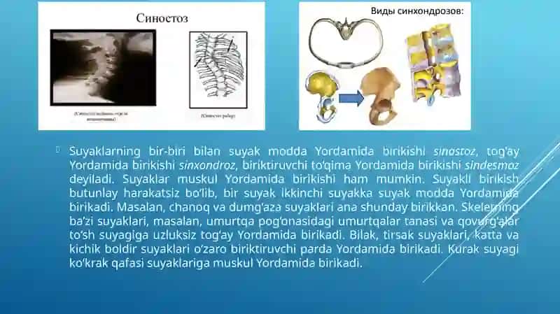 SINDESMOZ SINXONDOZ VA SINOSTOZ 2