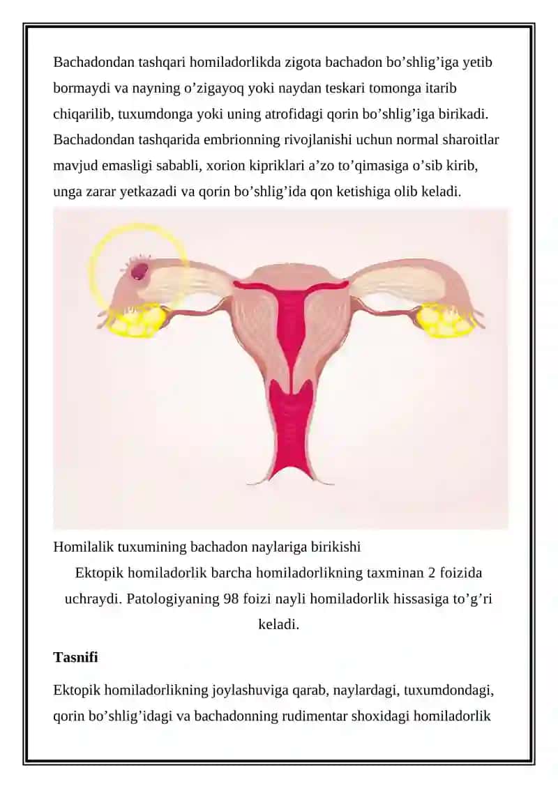 Bachadondan tashqari homiladorlik 2