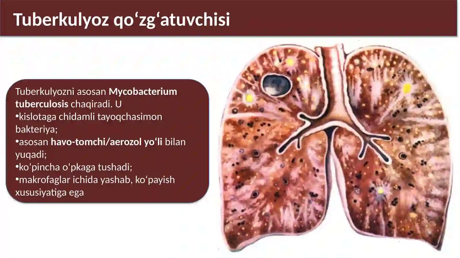 Tuberkulyoz patogenezi 2