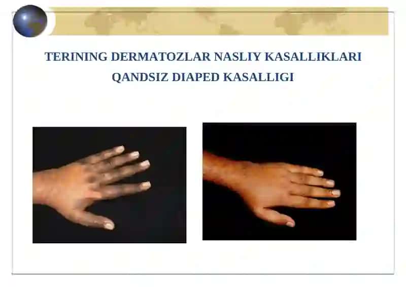 GENO DERMATOZ 2