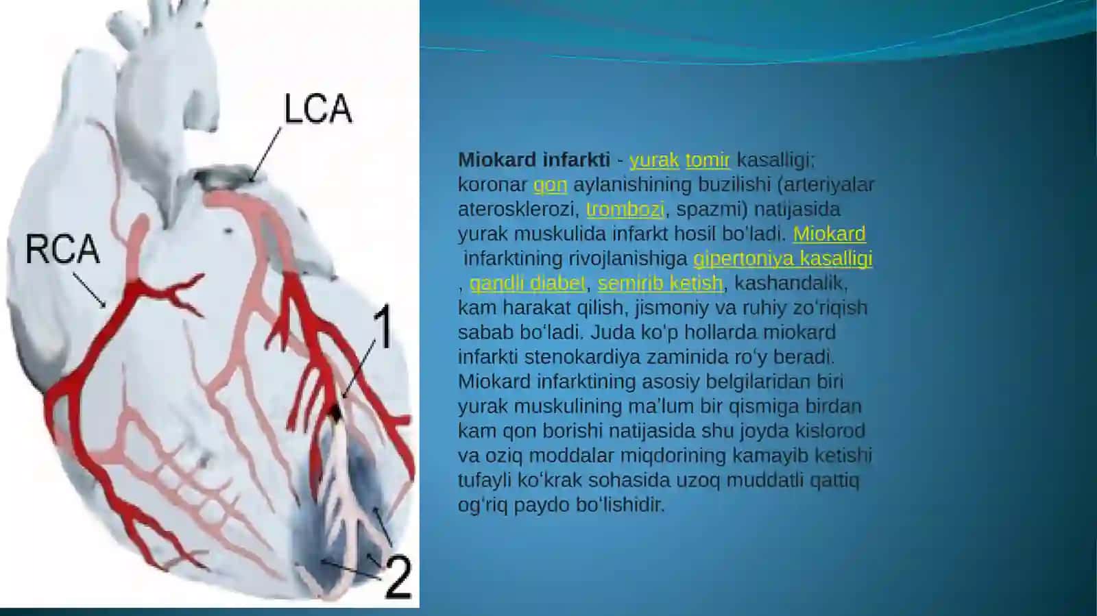 MIOKARD INFARKTI 2