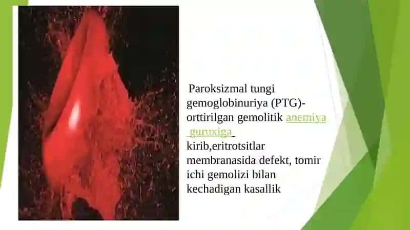 Paroksizmal tungi gemoglobinuriya 2