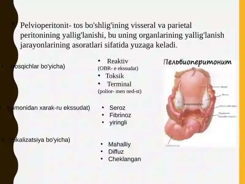 Ginekologik peritonit 2