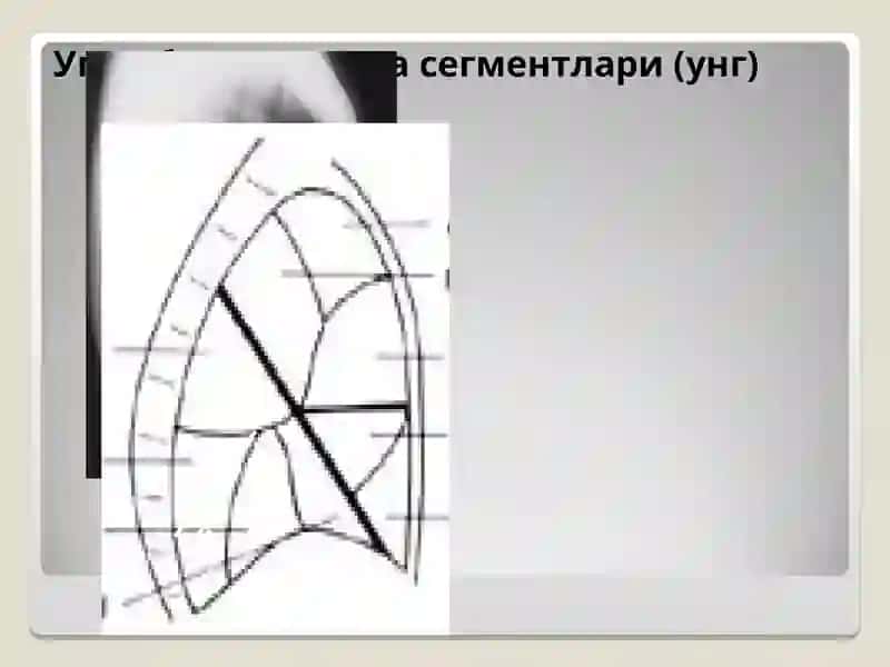NAFAS AZOLARI KASALLILARINING TASHXISIDA MAGNIT REZONANS TOMOGRAFIYANING AHAMIYATI 2