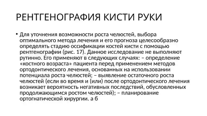 Рентгенограмма кисти руки 2