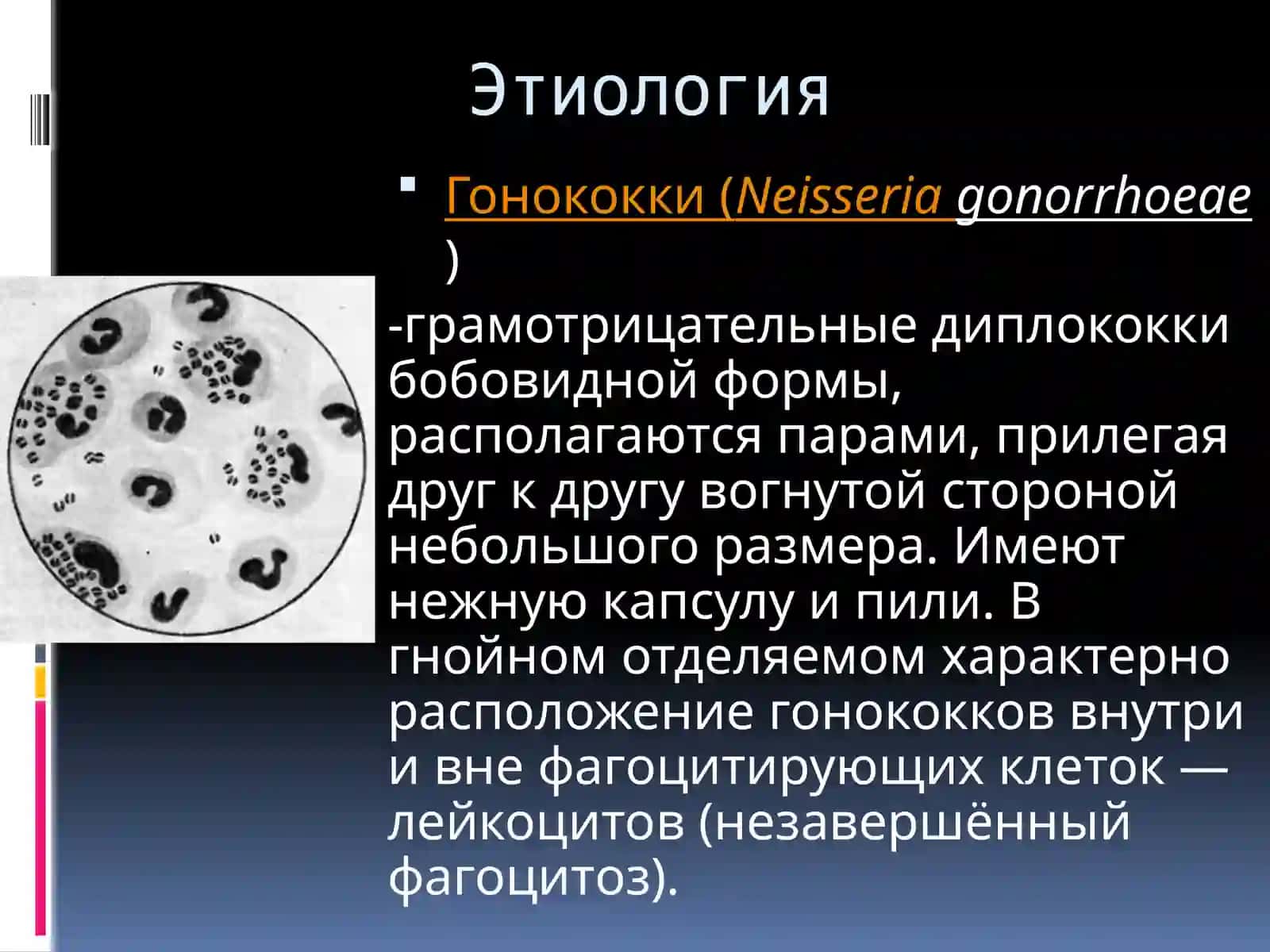 Гонорея 2