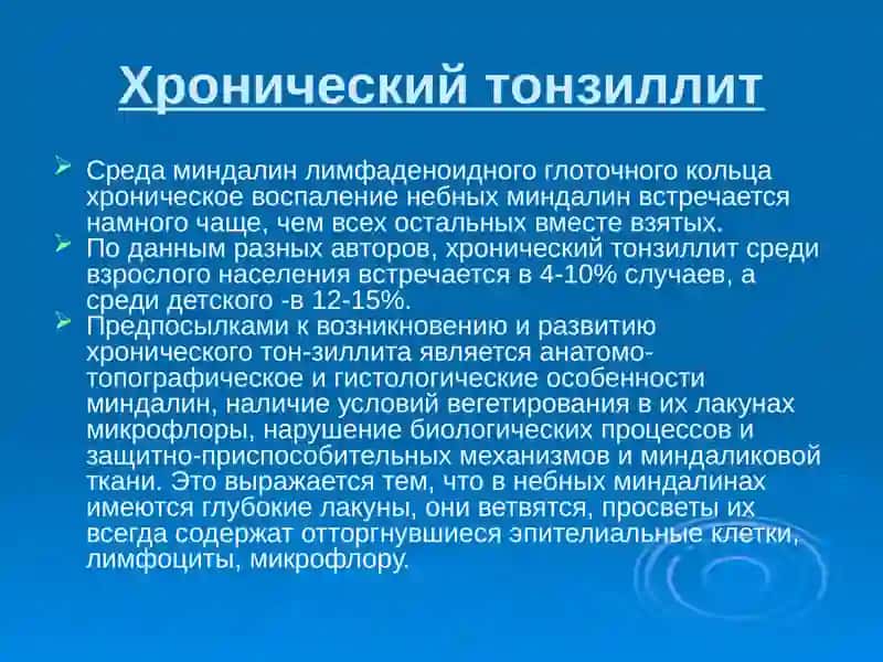 Хронический тонзиллит 2
