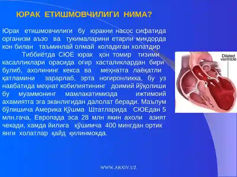 Ўткир қон айланиш синдроми 2