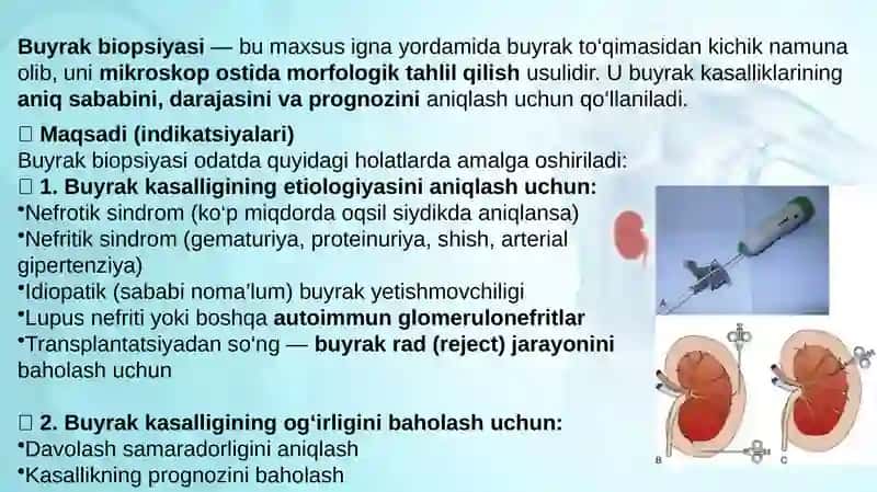Buyrak biopsiyasi 2