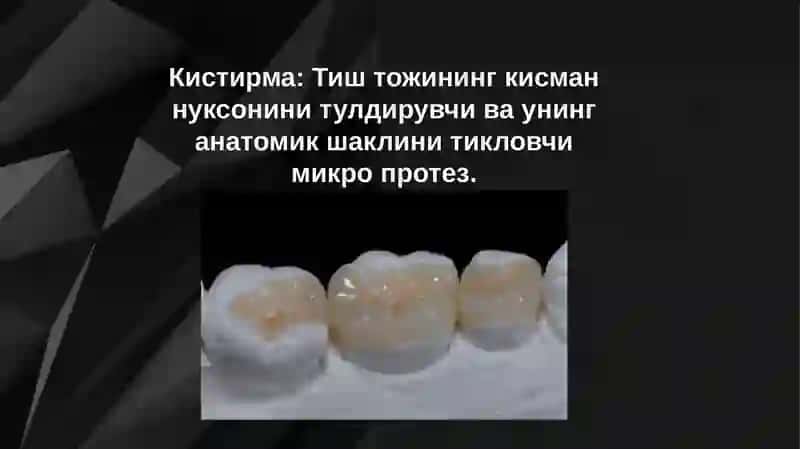 Qistirmalar turlari va qistirmalar uchun charxlash 2